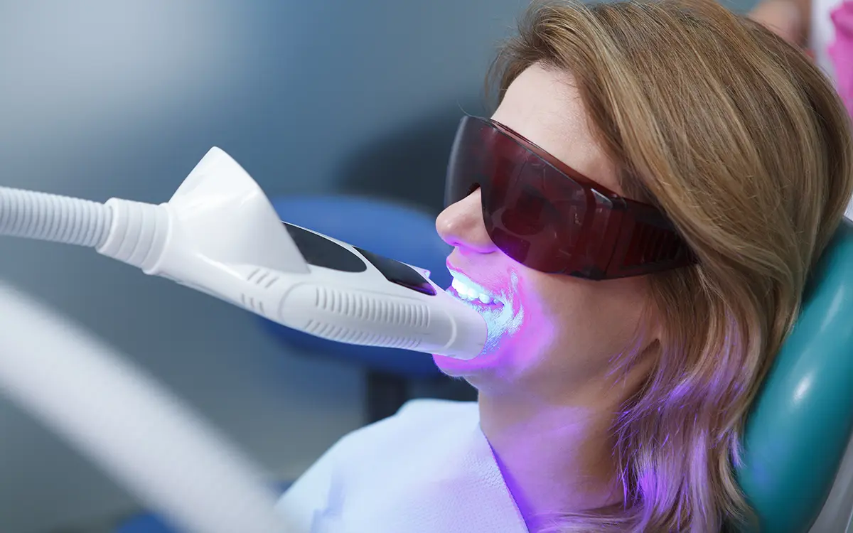 Diş beyazlatma, dişlerin yüzeyindeki renk değişikliklerini gidererek daha parlak ve estetik bir görünüm kazandırmayı amaçlayan kozmetik bir diş hekimliği uygulamasıdır. Günümüzün modern teknikleri sayesinde dişleriniz doğal ve sağlıklı bir beyazlığa kavuşur.