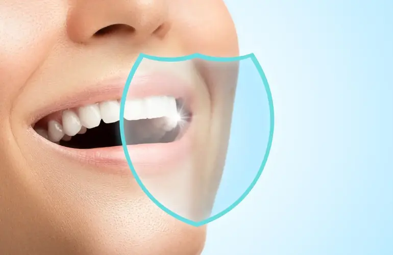 Koruyucu dolgu, dişlerin çürük oluşumuna eğilimli yüzeylerini kaplayarak çürüklerin oluşmasını engelleyen özel bir diş tedavisidir. Özellikle azı dişlerinin çiğneme yüzeyindeki derin girintilere ve çatlaklara uygulanan bu yöntem, çürüklerden korunmanın etkili bir yoludur.