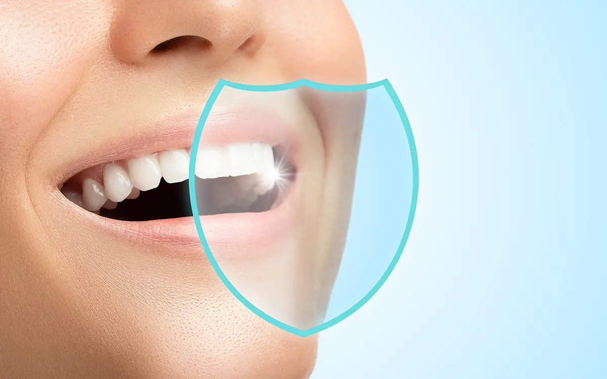 Koruyucu dolgu, dişlerin çürük oluşumuna eğilimli yüzeylerini kaplayarak çürüklerin oluşmasını engelleyen özel bir diş tedavisidir. Özellikle azı dişlerinin çiğneme yüzeyindeki derin girintilere ve çatlaklara uygulanan bu yöntem, çürüklerden korunmanın etkili bir yoludur.