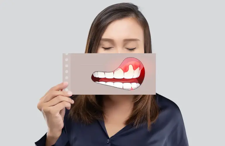 Pembe estetik, dişlerin etrafındaki diş etlerinin sağlıklı, simetrik ve estetik bir görünüme kavuşturulması için yapılan tedavileri kapsar. Diş estetiğinin tamamlayıcısı olan pembe estetik, sağlıklı bir gülüş tasarımı için diş etlerinin konumunu, rengini ve simetrisini düzeltmeyi hedefler.