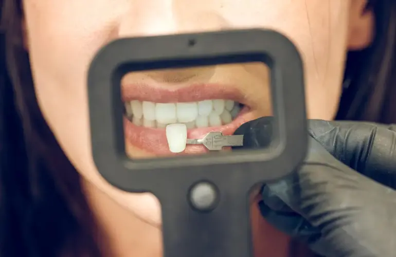 Zirkonyum restorasyonlar, diş kaybı, çürük veya estetik ihtiyaçlar nedeniyle dişlerin kaplanması için kullanılan dayanıklı, biyouyumlu ve estetik bir tedavi yöntemidir. Metal destekli kaplamaların aksine, zirkonyum kaplamalar doğal diş rengini mükemmel bir şekilde taklit eder ve sağlıklı bir ağız yapısı sağlar.